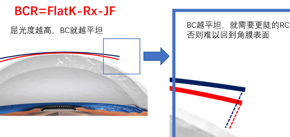 Reverse Curve 反转弧的意义