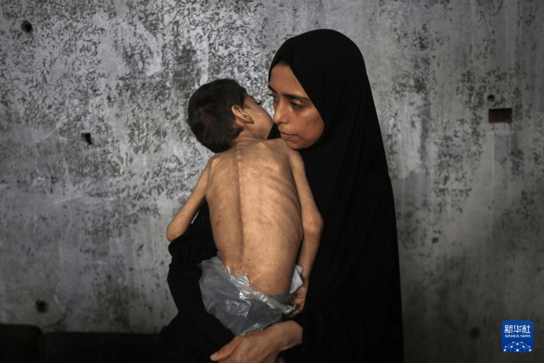 中东战地手记丨和平才是真正的“救命药”